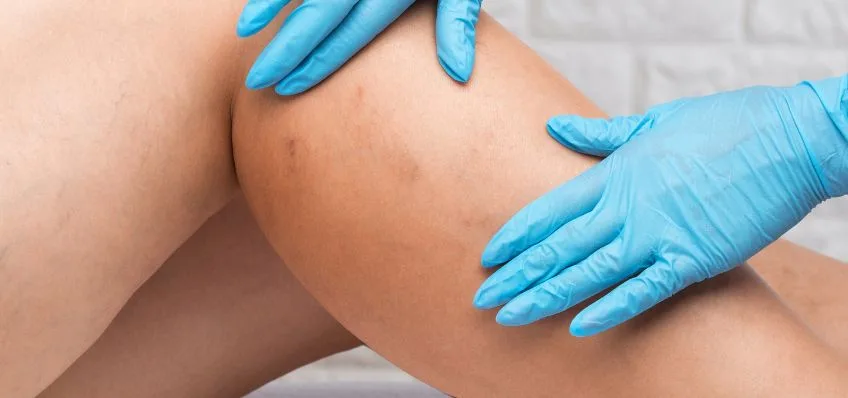 chirurgia naczyniowa