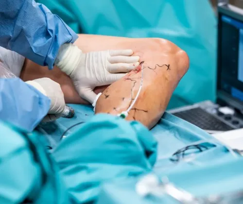 chirurgia naczyniowa