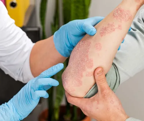 diagnoza zmian skórnych