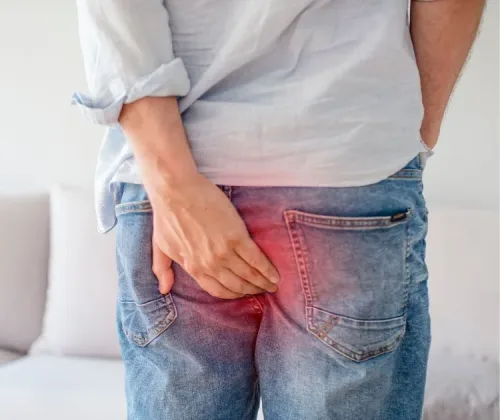 skleroterapia hemoroidów